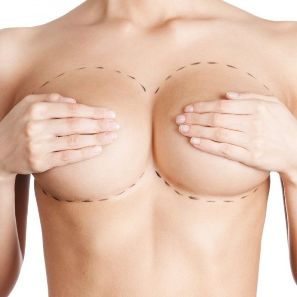 Brustvergrößerung
